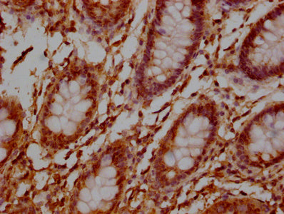 IHC image of TNFRSF17 Monoclonal Antibody diluted at 1:100 and staining in paraffin-embedded human colon tissue performed on a Leica BondTM system. After dewaxing and hydration, antigen retrieval was mediated by high pressure in a citrate buffer (pH 6.0). Section was blocked with 10% normal goat serum 30min at 37°C Then primary antibody (1% BSA) was incubated at 4°C overnight. The primary is detected by a Goat anti-Mouse IgG labeled by HRP and visualized using 0.05% DAB.Mouse anti-Human TNFRSF17 Monoclonal antibody