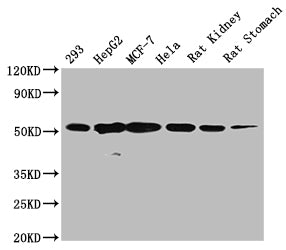 Western Blot Positive WB detected in: 293 whole cell lysate, HepG2 whole cell lysate, MCF-7 whole cell lysate, Hela whole cell lysate , Rat kidney tissue , Rat stomach tissue  All lanes TUBB antibody at 1:5000 Secondary Goat polyclonal to mouse IgG at 1/50000 dilution Predicted band size: 55 KDa Observed band size: 55 KDa Exposure time:5minMouse TUBB Monoclonal Antibody