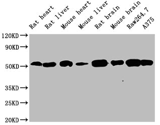Western Blot Positive WB detected in: Rat heart tissue ,Rat liver tissue, Mouse heart tissue, Mouse liver tissue, Rat brain tissue, Mouse brain tissue, Raw264.7 whole cell lysate, A375 whole cell lysate All lanes TUBB antibody at 1:5000 Secondary Goat polyclonal to mouse IgG at 1/50000 dilution Predicted band size: 55 KDa Observed band size: 55 KDa Exposure time:5minMouse TUBB Monoclonal Antibody