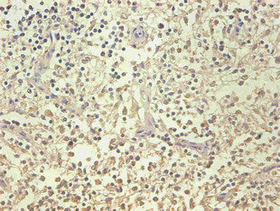 Immunohistochemical of paraffin-embedded human spleen organization using LCN2 Monoclonal Antibody at dilution of 1:200