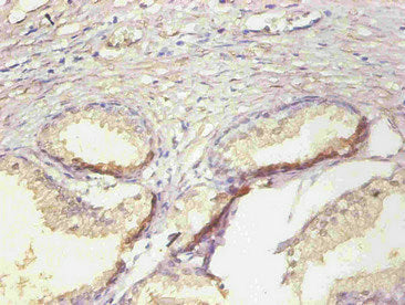 Immunohistochemical of paraffin-embedded human prostate tissue using LCN2 Monoclonal Antibody at dilution of 1:200