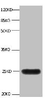 All lanes:Mouse anti-human Neutrophil gelatinase-associated lipocalin monoclonal antibody at 1μg/ml | Lane 1:NGAL transfected 293 cell lysate | Predicted band size : 22 kDa | Observed band size : 25 kDa