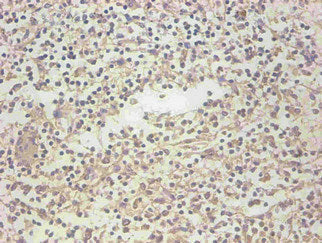 Immunohistochemical of paraffin-embedded human spleen organization using LCN2 Monoclonal Antibody at dilution of 1:200