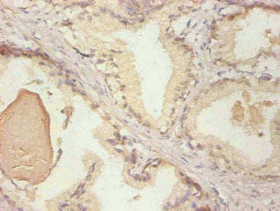 Immunohistochemical of paraffin-embedded human prostate tissue using LCN2 Monoclonal Antibody at dilution of 1:200