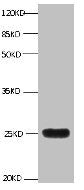 All lanes:Mouse anti-human Neutrophil gelatinase-associated lipocalin monoclonal antibody at 1μg/ml  | Lane 1:NGAL transfected 293 cell lysate  | Predicted band size : 22 kDa  | Observed band size : 25 kDa