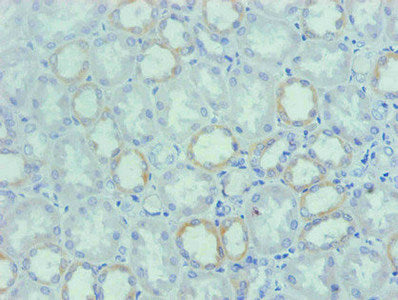 Immunohistochemical of paraffin-embedded human Kidney tissue using SPP1 Monoclonal Antibody at dilution of 1:200mouse anti-Human SPP1 Monoclonal Antibody