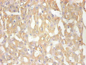 Immunohistochemical of paraffin-embedded human hepatic tissue using RBP4 Monoclonal Antibody at dilution of 1:200mouse anti-Human RBP4 Monoclonal Antibody