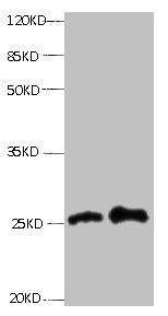 All lanes: Mouse anti- human Retinol-binding protein 4 monoclonal antibody at 0.3μg/ml | Lane 1: Human positive serum1:10 | Lane 2: Human positive serum1:100 | Secondary:HRP labeled Goat polyclonal to Mouse IgG at 1/3000 dilution | Predicted band size : 23kd | Observed band size : 27kdmouse anti-Human RBP4 Monoclonal Antibody