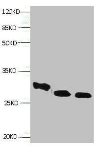All lanes: Mouse anti- human Retinol-binding protein 4 monoclonal antibody at 0.3μg/ml | Lane 1:RBP4 transfected E.coli lysate | Lane 2:Human positive serum1:100 | Lane 3:mouse liver tissue | Secondary:HRP labeled Goat polyclonal to Mouse IgG at 1/3000 dilution | Predicted band size : 23kd | Observed band size : 27kdmouse anti-Human RBP4 Monoclonal Antibody