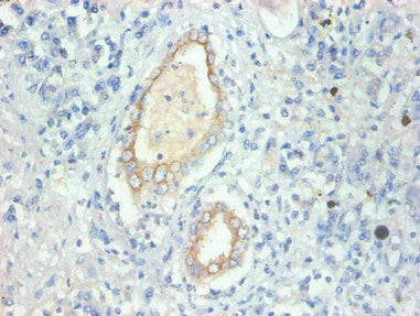 Immunohistochemical of paraffin-embedded human kidney tissue using FABP3 Monoclonal Antibody at dilution of 1:200mouse anti-Human FABP3 Monoclonal Antibody