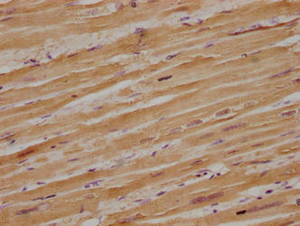 Immunohistochemical of paraffin-embedded human heart tissue using MB Monoclonal Antibody at dilution of 1:100