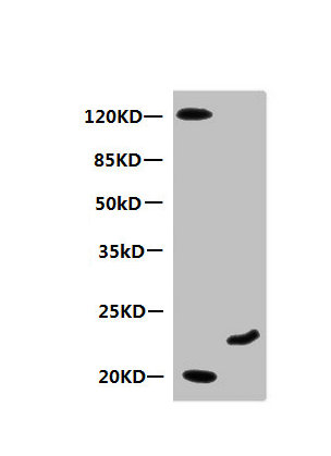 Western Blot  | All lanes: Mouse anti-Human Myoglobin monoclonal antibody at 0.3µg/ml  | Lane 1: Mouse heart muscle lysate  | Lane 2: Recombinant Myoglobin at 10µg  | Secondary HRP labeled Goat polyclonal to Mouse IgG at 1/3000 dilution  | Predicted band size: 18 kDa  | Observed band size: 20 kDa  | Additional bands at: 120 kDa