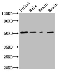 Western Blot analysis of paraffin-embedded Jurkat Hela,Mouse-brain,Rat-brain using  TUBG1 Monoclonal Antibody diluted at 1:1000.Mouse TUBG1 Monoclonal Antibody