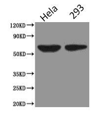 Western Blot  | Positive WB detected in: Hela whole cell lysate, HEK293 whole cell lysate  | All lanes: PODXL antibody at 2.5µg/ml  | Secondary  | Goat polyclonal to Mouse IgG at 1/5000 dilution  | Predicted band size: 59, 56 kDa  | Observed band size: 59 kDaMouse anti-Human PODXL Monoclonal Antibody