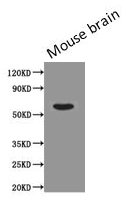Western Blot  | Positive WB detected in: Mouse brain tissue  | All lanes: PODXL antibody at 0.43µg/ml  | Secondary  | Goat polyclonal to Mouse IgG at 1/5000 dilution  | Predicted band size: 59, 56 kDa  | Observed band size: 59 kDaMouse anti-Human PODXL Monoclonal Antibody