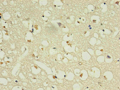 Immunohistochemistry of paraffin-embedded human brain using the antibody in 30μg/ml dilute concentrations.mouse anti-Human NPPB monoclonal antibody