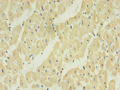 Immunohistochemistry of paraffin-embedded human heart using NPPB Monoclonal Antibody in 30μg/ml dilute concentrations.mouse anti-Human NPPB monoclonal antibody