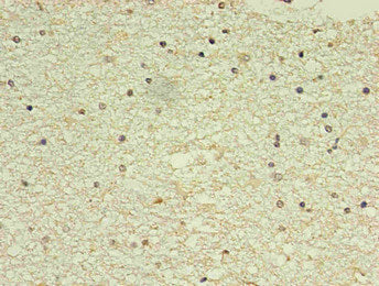 Immunohistochemistry of paraffin-embedded human brain using the antibody in 30μg/ml dilute concentrations.mouse anti-Human NPPB monoclonal antibody
