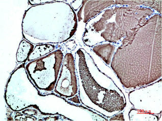 Immunohistochemical analysis of paraffin-embedded Human Thyroid Tissue using TTR Mouse mAb diluted at 1:200Mouse anti-Human TTR Monoclonal Antibody