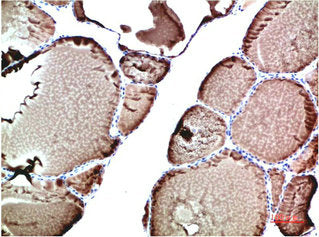 Immunohistochemical analysis of paraffin-embedded Human Thyroid Tissue using TTR Mouse mAb diluted at 1:200Mouse anti-Human TTR Monoclonal Antibody