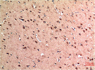 Immunohistochemical analysis of paraffin-embedded Human Brain Tissue using Beclin-1 Mouse mAb diluted at 1:200.Mouse anti-Human BECN1 Monoclonal Antibody