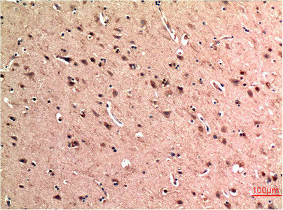 Immunohistochemical analysis of paraffin-embedded Human Brain Tissue using Beclin-1 Mouse mAb diluted at 1:200.Mouse anti-Human BECN1 Monoclonal Antibody