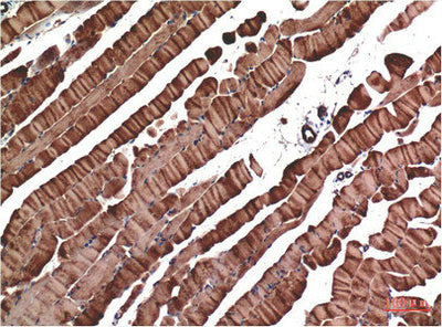 Immunohistochemical analysis of paraffin-embedded Mouse Skeletal Muscle Tissue using Muscle Actin Mouse mAb diluted at 1:200.Mouse anti-Human Muscle actin Monoclonal Antibody