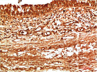Immunohistochemical analysis of paraffin-embedded Human Thyroid Tissue using TTR Mouse mAb diluted at 1:200Mouse anti-Human TTR Monoclonal Antibody