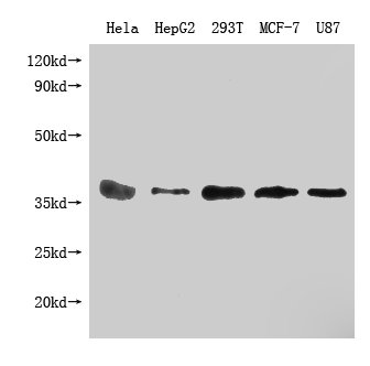 Western Blot Positive WB detected in: PPA1 antibody at 1:1000 Lane 1: Hela whole cell lysate Lane 2: HepG2 whole cell lysate Lane 3: 293T whole cell lysate Lane 4: MCF-7 whole cell lysate Lane 5: U87 whole cell lysateSecondary Goat polyclonal to Mouse IgG at 1/20000 dilution Predicted band size: 33KDa Observed band size: 33 KDa Exposure time: 5minMouse anti-Human PPA1 Monoclonal antibody