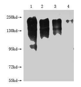 Western Blot Positive WB detected in: 1-4 lanes: 293T whole cell lysate transfected with MERTK at 10ug, 5ug, 2.5ug, 1.25ug All lanes: MERTK antibody at 1:2000 Secondary Goat polyclonal to mouse IgG at 1/50000 dilution Predicted band size: 150-250 KDa Observed band size: 150-250 KDa Exposure time：5S