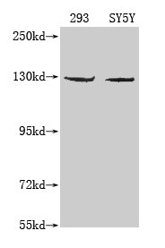 Western Blot Positive WB detected in: 293 whole cell lysate, SY5Y whole cell lysate, K562 whole cell lysate  All lanes: MERTK antibody at 1:1000 Secondary Goat polyclonal to mouse IgG at 1/50000 dilution Predicted band size: 110 kDa Observed band size: 130 KDa Exposure time：5min