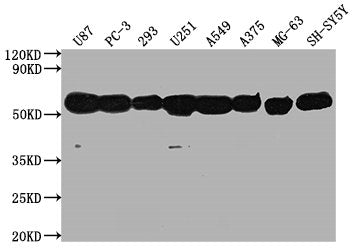 Western BlotPositive WB detected in:  U87 whole cell lysate, PC-3 whole cell lysate, 293 whole cell lysate, U251 whole cell lysate, A549 whole cell lysate, A375 whole cell lysate, MG-63 whole cell lysate, SH-SY5Y whole cell lysate, All lanes: TUBA1A antibody at 1:5000SecondaryGoat polyclonal to Mouse IgG at 1/10000 dilutionPredicted band size: 52 kDaObserved band size: 52 kDaMouse anti-Human TUBA1A Monoclonal Antibody antibody
