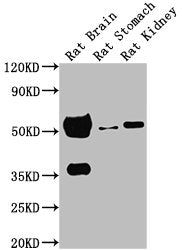Western BlotPositive WB detected in:  Rat brain tissue, Rat stomach tissue, Rat kidney tissueAll lanes: TUBA1A antibody at 1:5000SecondaryGoat polyclonal to Mouse IgG at 1/10000 dilutionPredicted band size: 52 kDaObserved band size: 52 kDaMouse anti-Human TUBA1A Monoclonal Antibody antibody