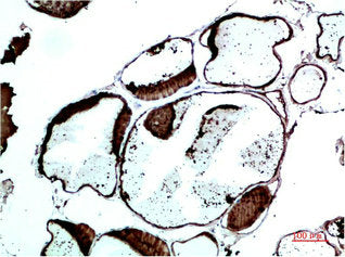 Immunohistochemical analysis of paraffin-embedded Human Thyroid Tissue using TTR Mouse mAb diluted at 1:200Mouse anti-Human TTR Monoclonal Antibody