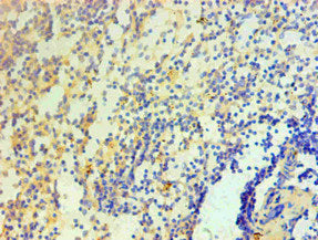 Immunohistochemical of paraffin-embedded Human spleen tissue using IL1F10 Monoclonal Antibody at dilution of 1:200.mouse anti-Human IL1F10 monoclonal antibody