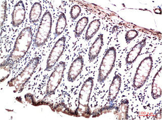 Immunohistochemical analysis of paraffin-embedded Human Colon Carcinoma Tissue using HP-1γ Mouse mAb diluted at 1:200Mouse anti-Human CBX3 Monoclonal Antibody
