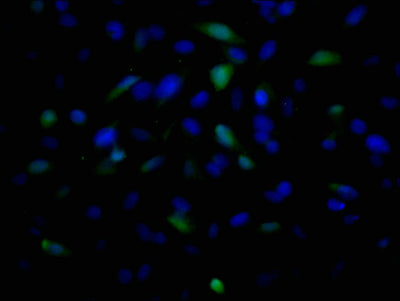 Immunofluorescence staining of U251 cells with TSG101 Monoclonal Antibody at 1:100, counter-stained with DAPI. The cells were fixed in 4% formaldehyde and blocked in 10% normal Goat Serum. The cells were incubated with the antibody overnight at 4°C. Nuclear DNA was labeled in blue with DAPI. The secondary antibody was FITC-conjugated AffiniPure Goat Anti-Mouse IgG (H+L).Mouse anti-Human TSG101 Monoclonal antibody