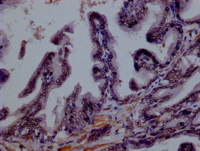 IHC image of SMURF1 Monoclonal Antibody diluted at 1:100 and staining in paraffin-embedded human prostate tissue performed on a Leica BondTM system. After dewaxing and hydration, antigen retrieval was mediated by high pressure in a citrate buffer (pH 6.0). Section was blocked with 10% normal goat serum 30min at RT. Then primary antibody (1% BSA) was incubated at 4°C overnight. The primary is detected by a biotinylated secondary antibody and visualized using an HRP conjugated SP system.Mouse anti-Human SMURF1 Monoclonal antibody