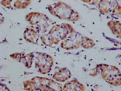 IHC image of SMURF1 Monoclonal Antibody diluted at 1:100 and staining in paraffin-embedded human stomach tissue performed on a Leica BondTM system. After dewaxing and hydration, antigen retrieval was mediated by high pressure in a citrate buffer (pH 6.0). Section was blocked with 10% normal goat serum 30min at RT. Then primary antibody (1% BSA) was incubated at 4°C overnight. The primary is detected by a biotinylated secondary antibody and visualized using an HRP conjugated SP system.Mouse anti-Human SMURF1 Monoclonal antibody