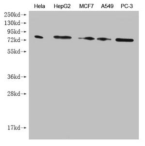 Western Blot Positive WB detected in: Hela whole cell lysate, HepG2 whole cell lysate, MCF7 whole cell lysate, A549 whole cell lysate, PC-3 whole cell lysate  All lanes: SMURF1 antibody at 1:1000 Secondary Goat polyclonal to mouse IgG at 1/50000 dilution Predicted band size: 86 kDa Observed band size: 86 KDa Exposure time：5minMouse anti-Human SMURF1 Monoclonal antibody