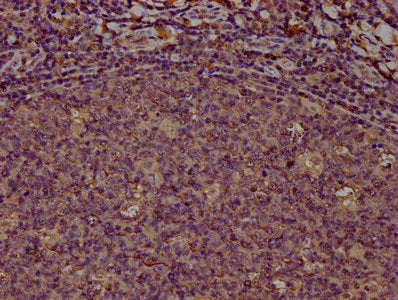 IHC image of PD-L1 Monoclonal Antibody diluted at 1:100 and staining in paraffin-embedded human tonsil tissue performed on a Leica BondTM system. After dewaxing and hydration, antigen retrieval was mediated by high pressure in a citrate buffer (pH 6.0). Section was blocked with 10% normal goat serum 30min at RT. Then primary antibody (1% BSA) was incubated at 4°C overnight. The primary is detected by a biotinylated secondary antibody and visualized using an HRP conjugated SP system.Mouse anti-Human PD-L1 Monoclonal Antibody