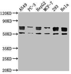 Western Blot  | Positive WB detected in: A549 whole cell lysate, PC-3 whole cell lysate, HepG2 whole cell lysate, MCF-7 whole cell lysate, 293 whole cell lysate, Hela whole cell lysate  | All lanes: PD-L1 antibody at 1:1000  | Secondary  | Goat polyclonal to Mouse IgG at 1/10000 dilution  | Predicted band size: 34, 21 kDa  | Observed band size: 55, 70 kDaMouse anti-Human PD-L1 Monoclonal Antibody