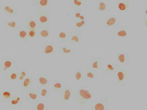 Immunocytochemistry analysis of NANOG Monoclonal Antibody diluted at 1:100 and staining in Hela cells performed on a Leica BondTM system. The cells were fixed in 4% formaldehyde, permeabilized using 0.2% Triton X-100 and blocked with 10% normal goat serum 30min at RT. Then primary antibody (1% BSA) was incubated at 4°C overnight. The primary is detected by a biotinylated secondary antibody and visualized using an HRP conjugated SP system.Mouse anti-Human NANOG Monoclonal Antibody