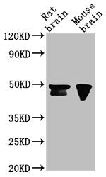 Western Blot  | Positive WB detected in: Rat brain tissue, Mouse brain tissue  | All lanes: NANOG antibody at 1:500  | Secondary  | Goat polyclonal to Mouse IgG at 1/10000 dilution  | Predicted band size: 35, 33 kDa  | Observed band size: 46, 42 kDaMouse anti-Human NANOG Monoclonal Antibody