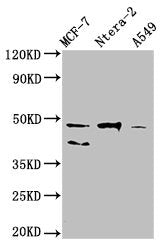 Western Blot  | Positive WB detected in: MCF-7 whole cell lysate, Ntera-2 whole cell lysate, A549 whole cell lysate  | All lanes: NANOG antibody at 1:500  | Secondary  | Goat polyclonal to Mouse IgG at 1/10000 dilution  | Predicted band size: 35, 33 kDa  | Observed band size: 46, 40 kDaMouse anti-Human NANOG Monoclonal Antibody