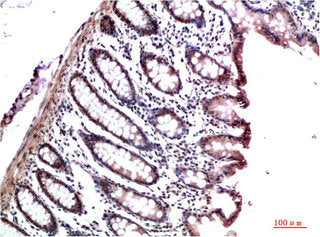 Immunohistochemical analysis of paraffin-embedded Human Colon Carcinoma Tissue using HP-1γ Mouse mAb diluted at 1:200Mouse anti-Human CBX3 Monoclonal Antibody