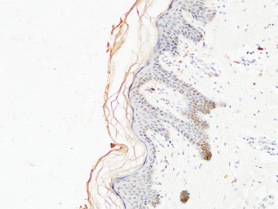 Immunohistochemical analysis of paraffin-embedded Human skin. COL1A1 Antibody was diluted at 1:200.Mouse anti-Human COL1A1 Monoclonal Antibody