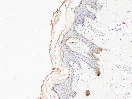 Immunohistochemical analysis of paraffin-embedded Human skin. COL1A1 Antibody was diluted at 1:200.Mouse anti-Human COL1A1 Monoclonal Antibody