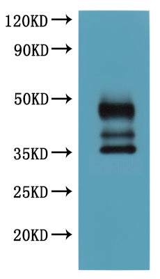 BLC-06196P is detected by Mouse anti-6*His monoclonal antibody.Recombinant Human C-C Chemokine Receptor Type 9 (CCR9) Protein (His)