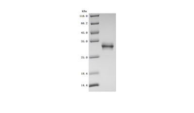 Greater than 95% as determined by SDS-PAGE.Recombinant Human Oncostatin-M (OSM) Protein (His), Active